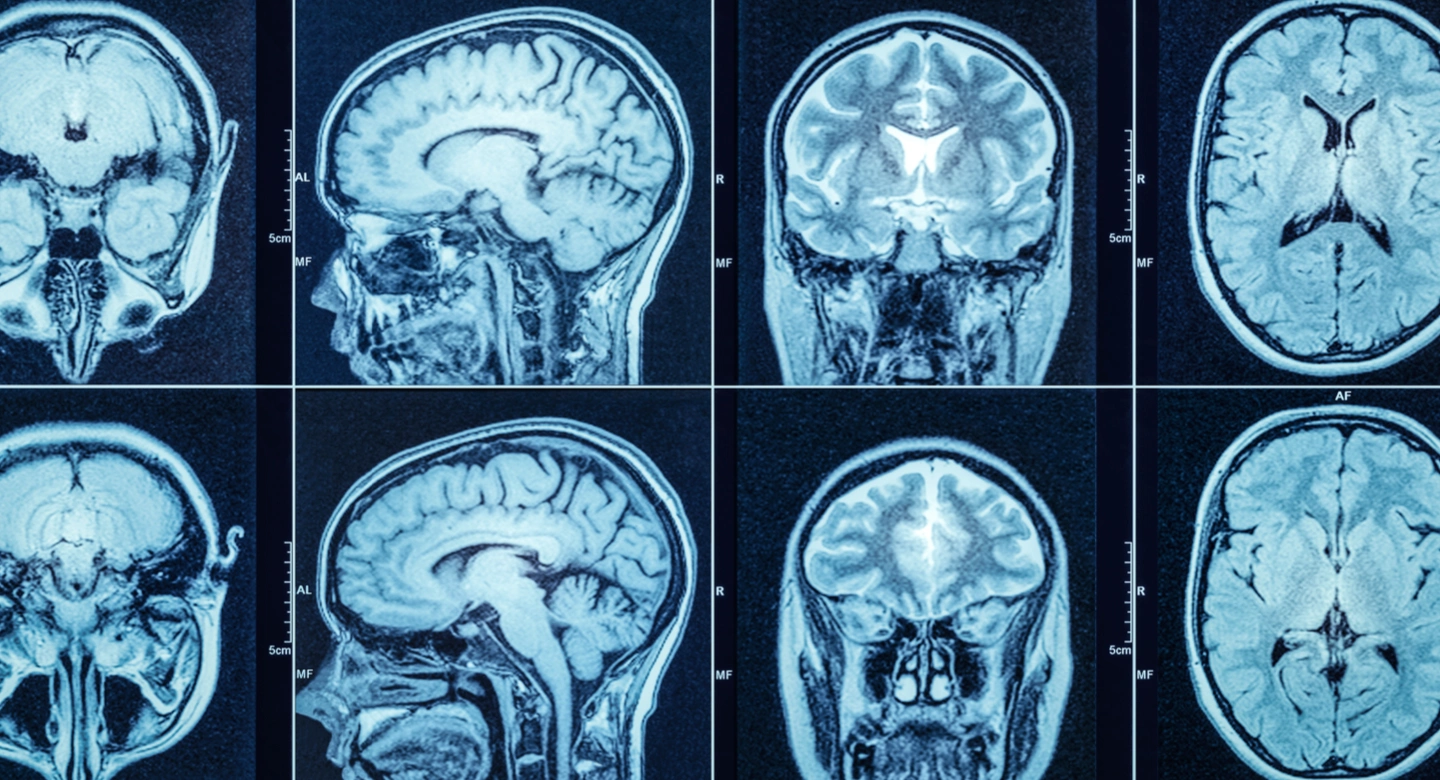 reviewing CT scans to see fractures